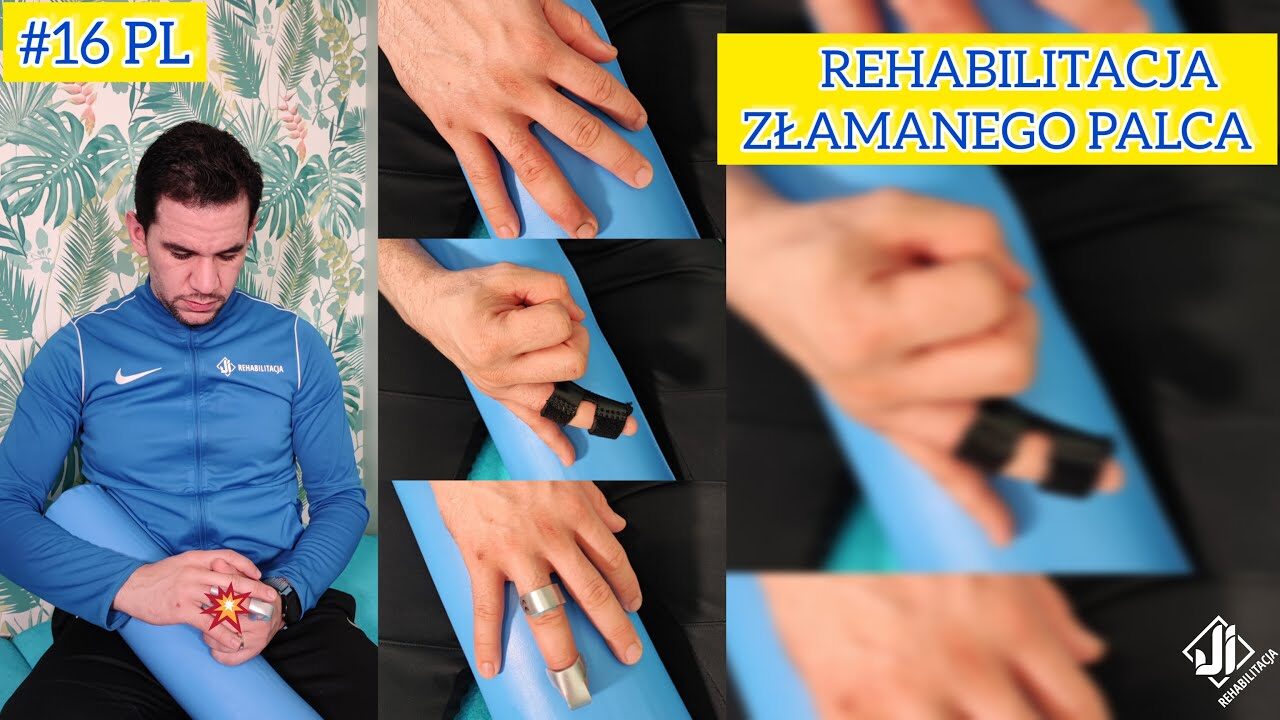 Rehabilitacja złamanego palca