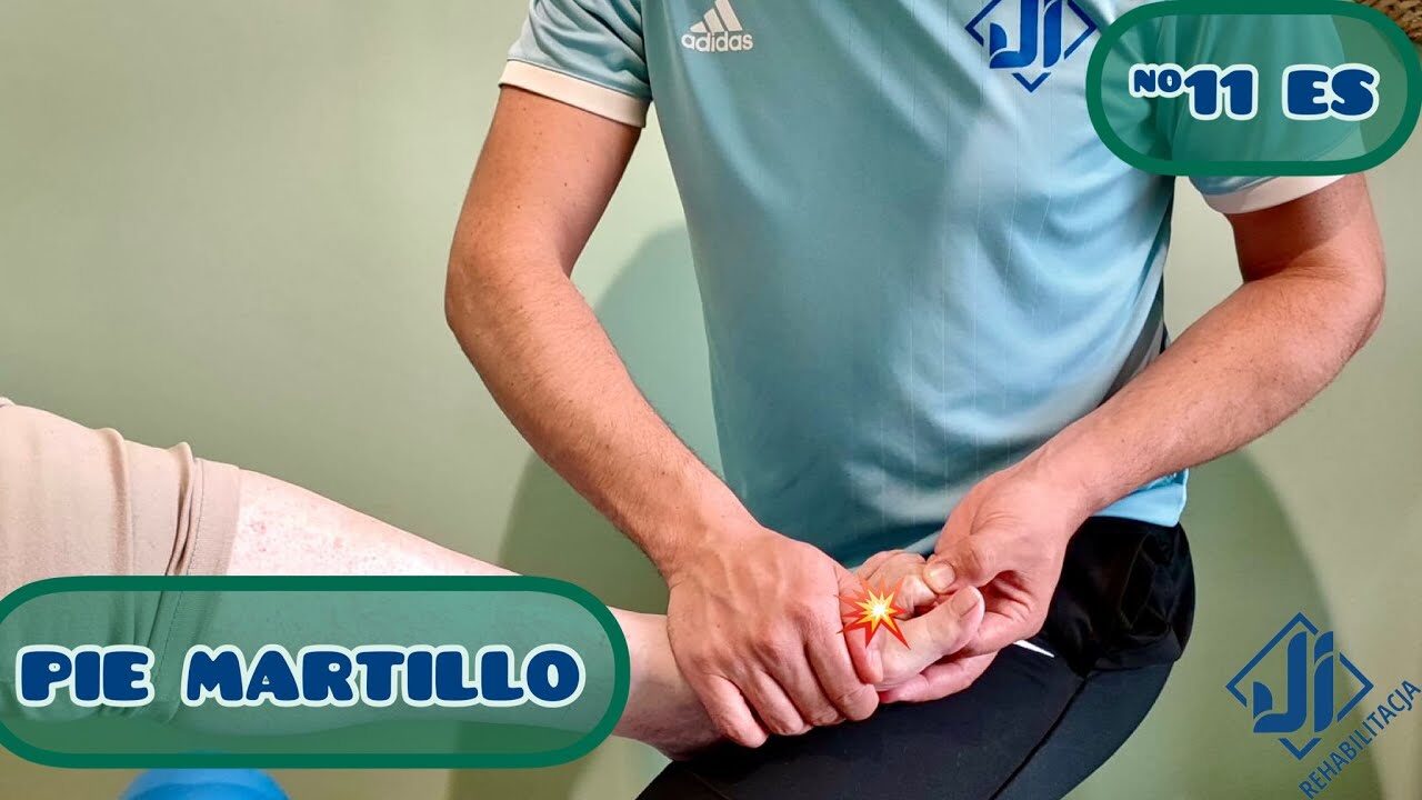¿Cómo evitar tener dedo martillo? Haz esto y automáticamente notarás el cambio