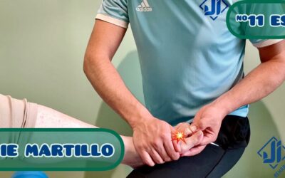 ¿Cómo evitar tener dedo martillo? Haz esto y automáticamente notarás el cambio