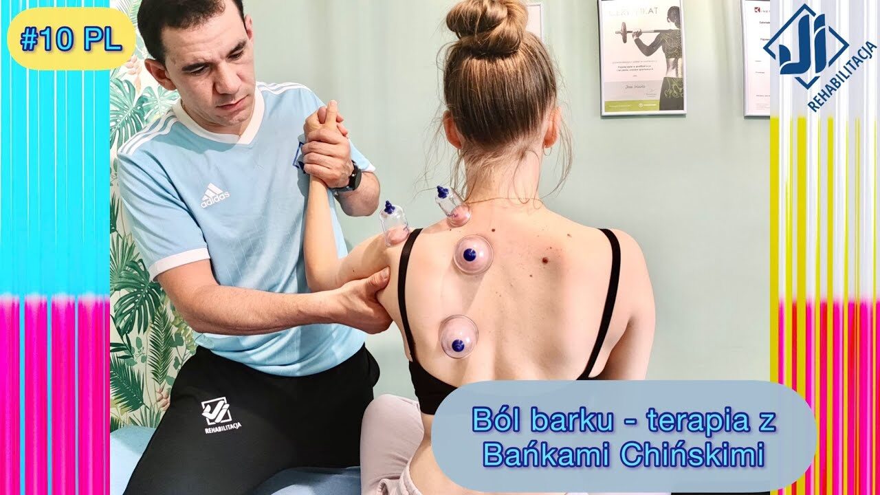 Jak rehabilitować ból barku? Sprawdź jak działa terapia z bańkami chińskimi