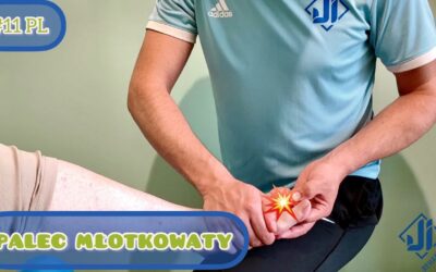 Palec młotkowaty